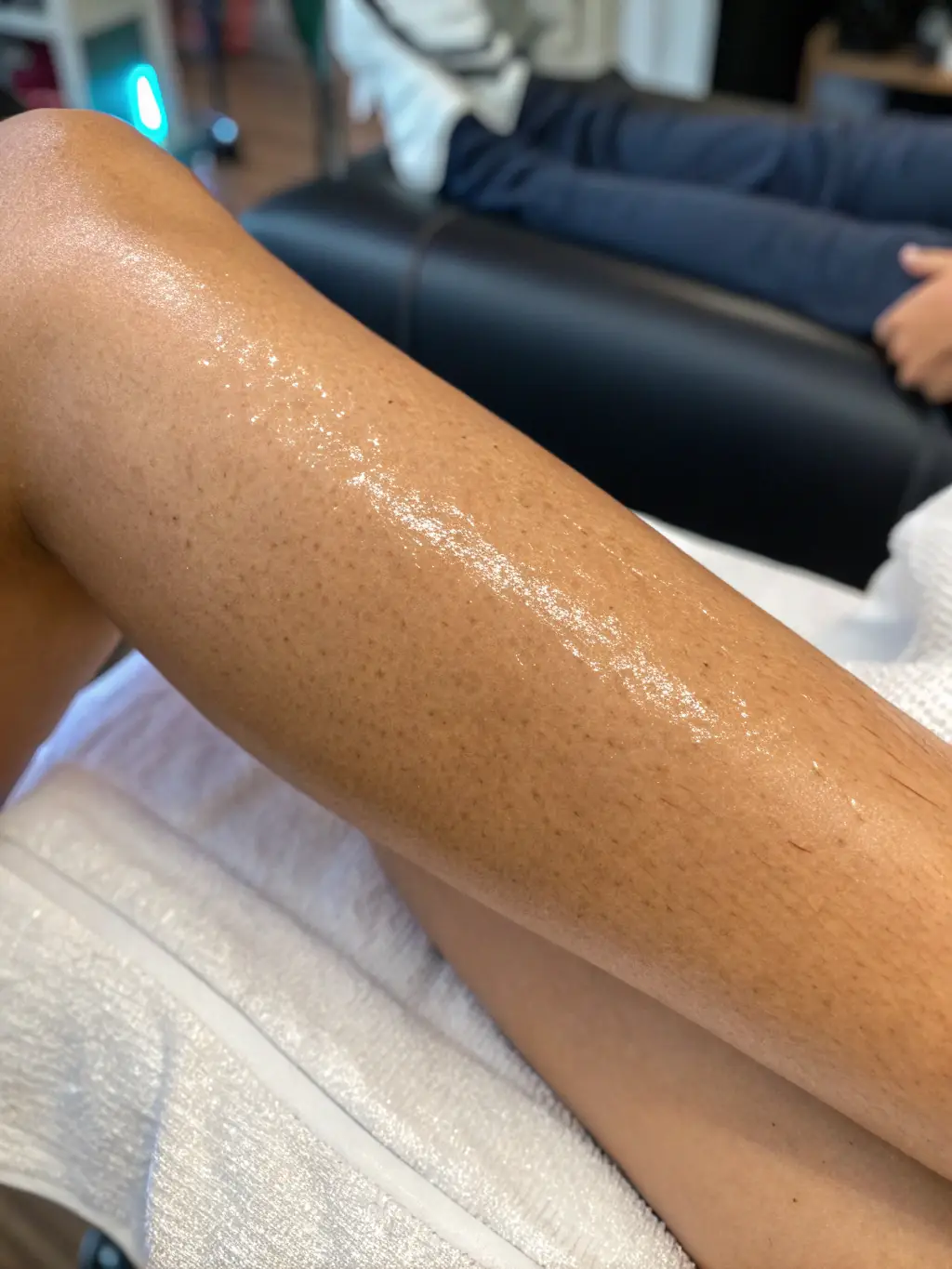 A close-up shot of a laser hair removal session on a client's leg, showcasing the precision and technology used at BeautyLine Spa.